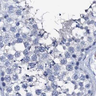 Immunohistochemistry-Paraffin: Nrip2 Antibody [NBP1-85034]