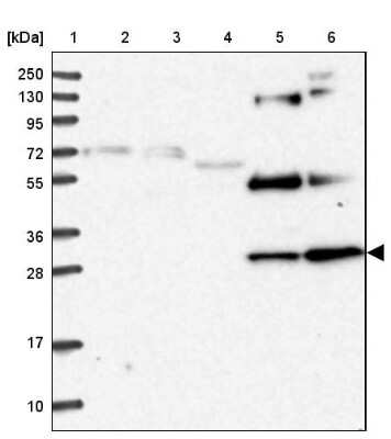 Western Blot: Nrip2 Antibody [NBP1-85033]