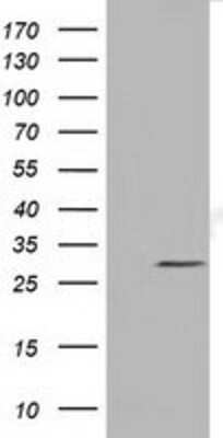 Western Blot: Nse2 Antibody (OTI6A6) [NBP2-02956]