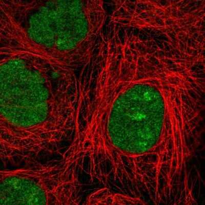 Immunocytochemistry/ Immunofluorescence: Nse2 Antibody [NBP2-58712]