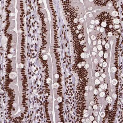 Immunohistochemistry-Paraffin: Nse2 Antibody [NBP2-49459]