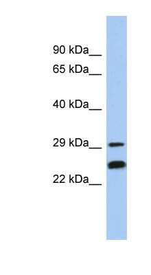 Western Blot: Nse2 Antibody [NBP1-56293]