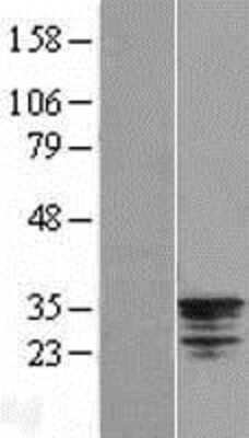 Western Blot: Nse2 Overexpression Lysate [NBL1-13812]