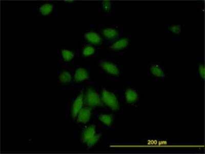 Immunocytochemistry/ Immunofluorescence: NuMA Antibody (1C5) [H00004926-M01]
