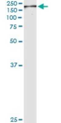 Immunoprecipitation: NuMA Antibody (1C5) [H00004926-M01]