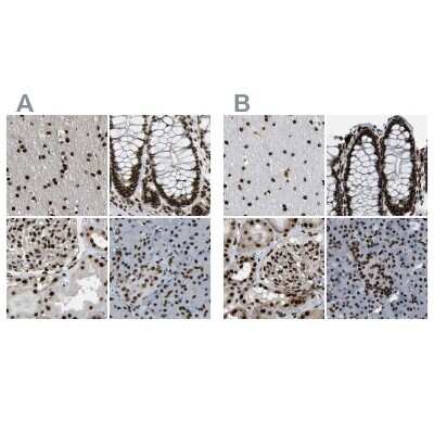 Immunohistochemistry-Paraffin: NuMA Antibody [NBP2-54673]