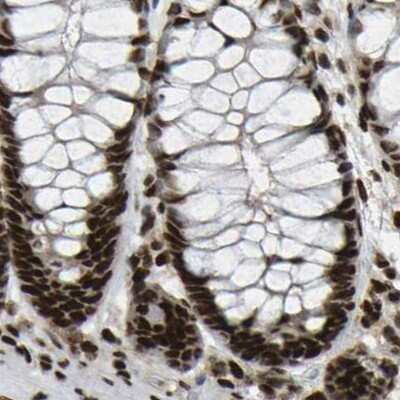 Immunohistochemistry-Paraffin: NuMA Antibody [NBP2-54673]