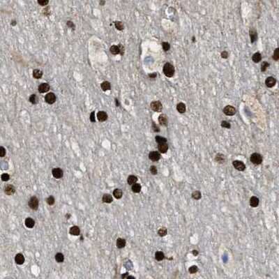 Immunohistochemistry-Paraffin: NuMA Antibody [NBP2-54673]