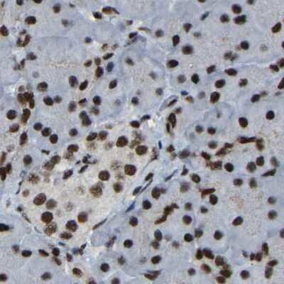 Immunohistochemistry-Paraffin: NuMA Antibody [NBP2-54673]