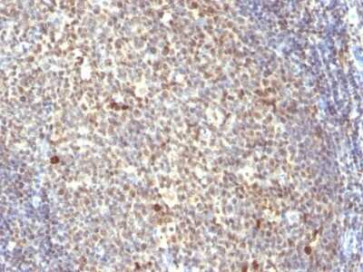 Immunohistochemistry-Paraffin: NuMA Antibody (SPM300) [NBP2-45227]