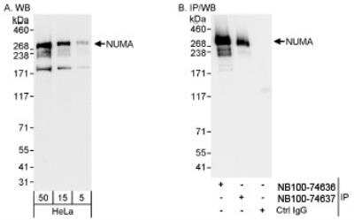 Western Blot: NuMA Antibody [NB100-74636]