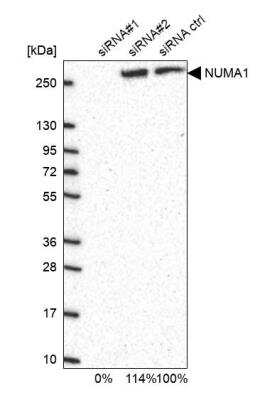 Western Blot: NuMA Antibody [NBP2-54672]