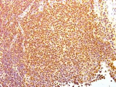 Immunohistochemistry-Frozen: Nuclear Antigen Antibody (235-1) - Azide and BSA Free [NBP2-34525]