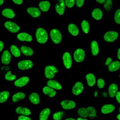 Nuclear Antigen Antibody (235-1R)
