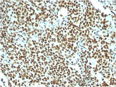 Immunohistochemistry-Paraffin: Nuclear Antigen Antibody (NM106) - IHC-Prediluted [NBP2-48213]