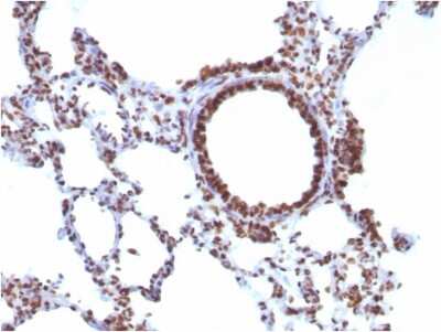 Immunohistochemistry-Paraffin: Nuclear Antigen Antibody (NM106) - IHC-Prediluted [NBP2-48213]