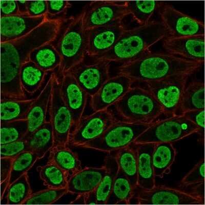 Immunocytochemistry/ Immunofluorescence: Nuclear Antigen Antibody (NM106) [NBP2-45273]