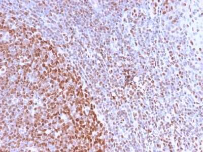Immunohistochemistry-Paraffin: Nuclear Antigen Antibody (NM2984R) - Azide and BSA Free [NBP3-08513]