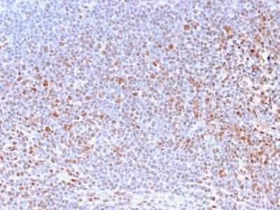 Immunohistochemistry-Paraffin: Nuclear Antigen Antibody (NM2984R) - Azide and BSA Free [NBP3-08513]