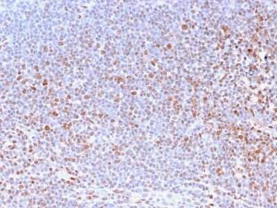 Immunohistochemistry-Paraffin: Nuclear Antigen Antibody (NM2984R) [NBP3-07303]