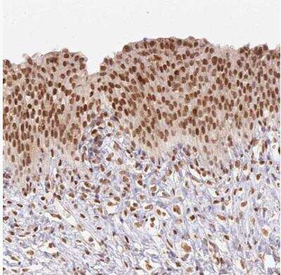 Immunohistochemistry-Paraffin: Nuclear Factor Erythroid 2 Related Factor 1 Antibody [NBP2-39057]