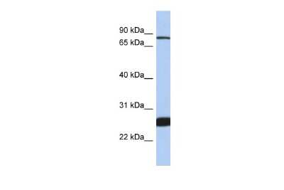 Western Blot: Nuclear Factor Erythroid 2 Related Factor 1 Antibody [NBP2-87953]