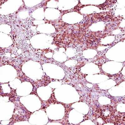 Immunohistochemistry-Paraffin: Nuclear Factor Erythroid Derived 2 Antibody [NBP1-82580]