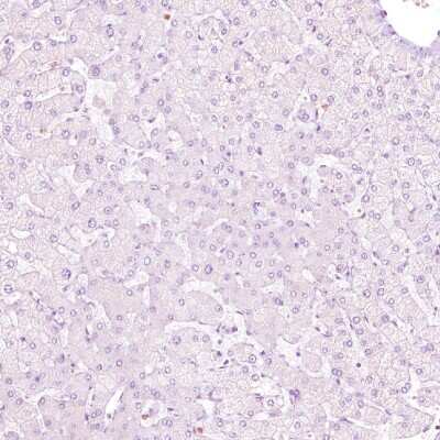 Immunohistochemistry-Paraffin: Nuclear Factor Erythroid Derived 2 Antibody [NBP1-82580]