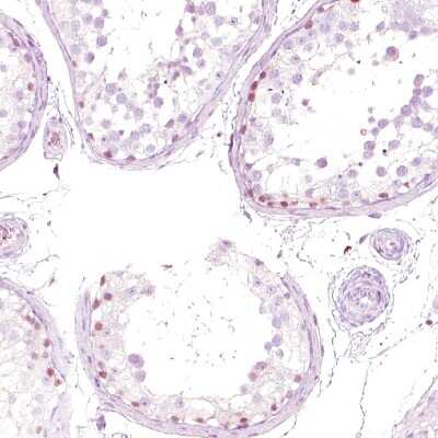 Immunohistochemistry-Paraffin: Nuclear Factor Erythroid Derived 2 Antibody [NBP1-82580]