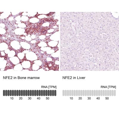 Immunohistochemistry-Paraffin: Nuclear Factor Erythroid Derived 2 Antibody [NBP1-82580]