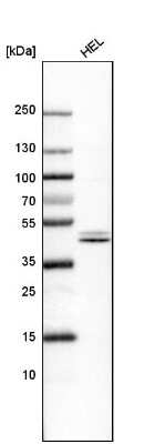 Western Blot: Nuclear Factor Erythroid Derived 2 Antibody [NBP1-82580]