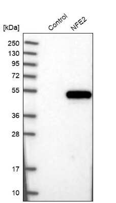 Western Blot: Nuclear Factor Erythroid Derived 2 Antibody [NBP1-82580]