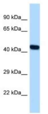 Western Blot: Nuclear Factor Erythroid Derived 2 Antibody [NBP3-10897]