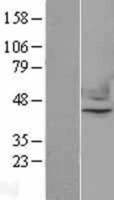 Western Blot: Nuclear Factor Erythroid Derived 2 Overexpression Lysate [NBL1-13612]