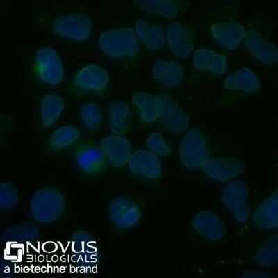 Immunocytochemistry/ Immunofluorescence: Nuclear Membrane Marker Antibody (NM97) [NBP2-32885]