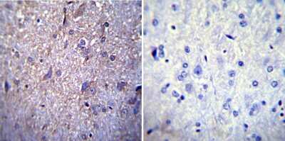 Immunohistochemistry-Paraffin: Nuclear Pore-O-Linked Glycoprotein Antibody (RL1) [NB600-1068]
