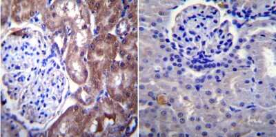 Immunohistochemistry-Paraffin: Nuclear Pore-O-Linked Glycoprotein Antibody (RL1) [NB600-1068]