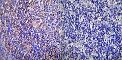 Immunohistochemistry-Paraffin: Nuclear Pore-O-Linked Glycoprotein Antibody (RL1) [NB600-1068]