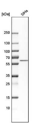 Western Blot: Nucleobindin 1 Antibody [NBP1-88217]