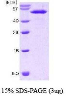 SDS-PAGE: Recombinant Mouse Nesfatin-1/Nucleobindin-2 His Protein [NBC1-18398]