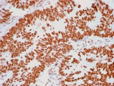 Immunohistochemistry-Paraffin: Nucleoli Marker Antibody (NM95) - Azide and BSA Free [NBP2-34695]