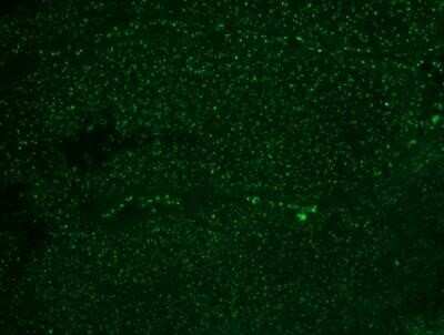 Immunohistochemistry-Paraffin: Nucleoli Marker Antibody (NM95) - Azide and BSA Free [NBP2-34695]