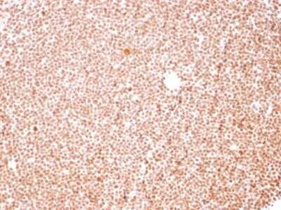 Immunohistochemistry-Paraffin: Nucleoli Marker Antibody (NM95) - IHC-Prediluted [NBP2-45215]