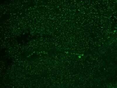 Immunohistochemistry-Paraffin: Nucleoli Marker Antibody (NM95) - IHC-Prediluted [NBP2-45215]