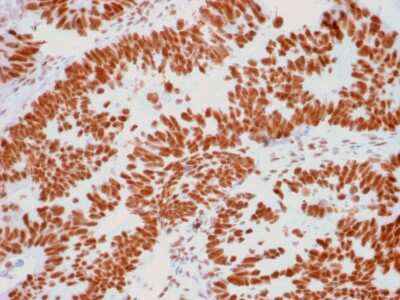Immunohistochemistry-Paraffin: Nucleoli Marker Antibody (NM95) [NBP2-32886]