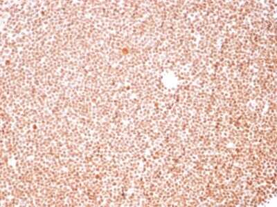 Immunohistochemistry-Paraffin: Nucleoli Marker Antibody (NM95) [NBP2-32886]