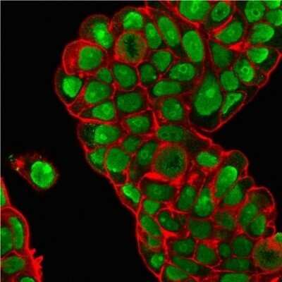 Immunocytochemistry/ Immunofluorescence: Nucleolin Antibody (364-5 + NCL/902) - Azide and BSA Free [NBP2-47862]