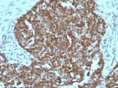 Immunohistochemistry-Paraffin: Nucleolin Antibody (364-5 + NCL/902) - Azide and BSA Free [NBP2-47862]
