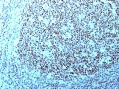 Immunohistochemistry-Paraffin: Nucleolin Antibody (364-5 + NCL/902) - Azide and BSA Free [NBP2-47862]