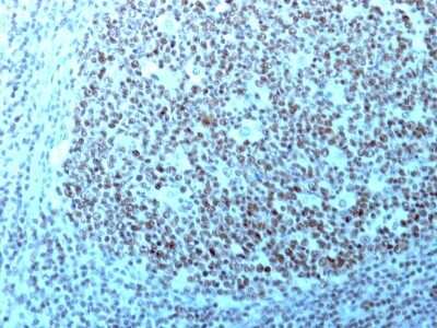 Immunohistochemistry-Paraffin: Nucleolin Antibody (364-5 + NCL/902) [NBP2-44613]